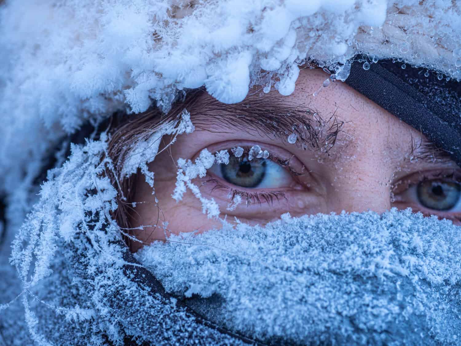 Visage givré par le froid extrême au Yukon